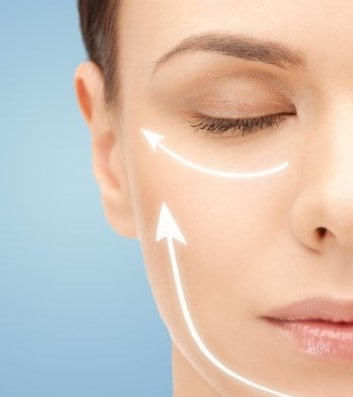 Facelift