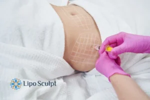Are The Results From Aqualyx Permanent? 1 Do you want to know how long Aqualyx Beccles results last?