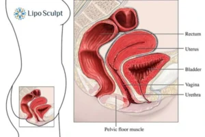 Treatment For A Leaky Bladder 2 How EM Chair treatment Beccles can help Leaky bladder issues. Read more now!