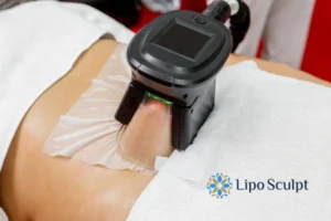 Does Fat Freezing At Home Work? 3 Fat freezing at home from Lipo Sculpt Beccles